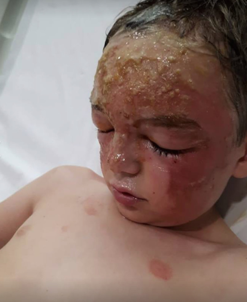 Other image for Three arrests following child’s scalding